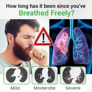 HISTONE® Lung health Detox Inhaler
