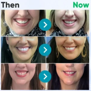 🇬🇧👨🏼‍⚕️Rolimey® VioGloss Bee Venom Dental Therapy Oral Power🦷