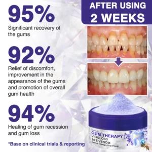 🇬🇧👨🏼‍⚕️Rolimey® VioGloss Bee Venom Dental Therapy Oral Power🦷