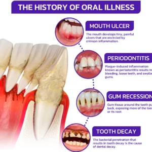 🇬🇧👨🏼‍⚕️Rolimey® VioGloss Bee Venom Dental Therapy Oral Power🦷