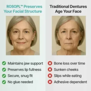 ROSOPL™ Custom-Fit Functional Dentures