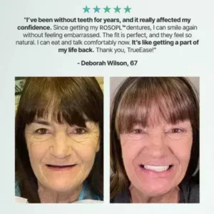 ROSOPL™ Custom-Fit Functional Dentures